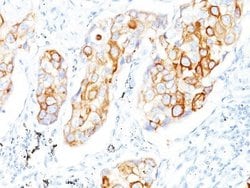 Cytokeratin 7/17 Antibody (C-46) - Azide and BSA Free, Novus Biologicals